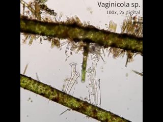 two vaginicola by microbepeeps/biology